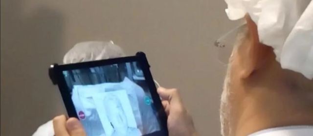 Argentine surgeons used a 3D mask to rebuild a face with deep burns