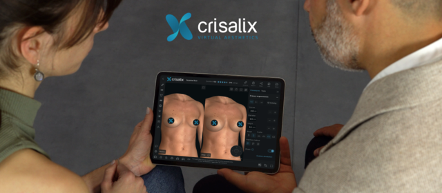 From 3D to 4D: The Future of Dynamic Aesthetic Simulations