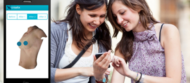 Crisalix now in smartphones and tablets
